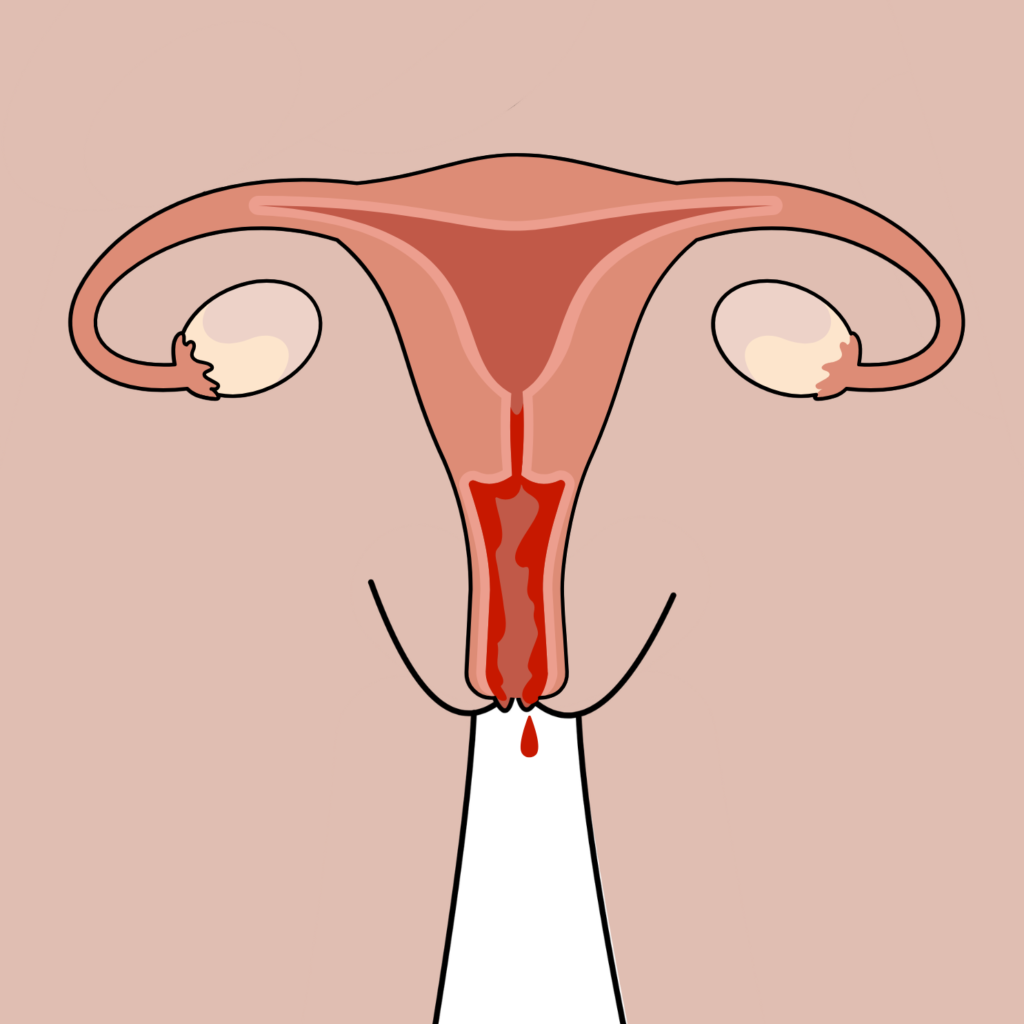 Illustration of the uterus, ovaries and fallopian tubes with menstrual blood flowing through the cervix and out of the body.