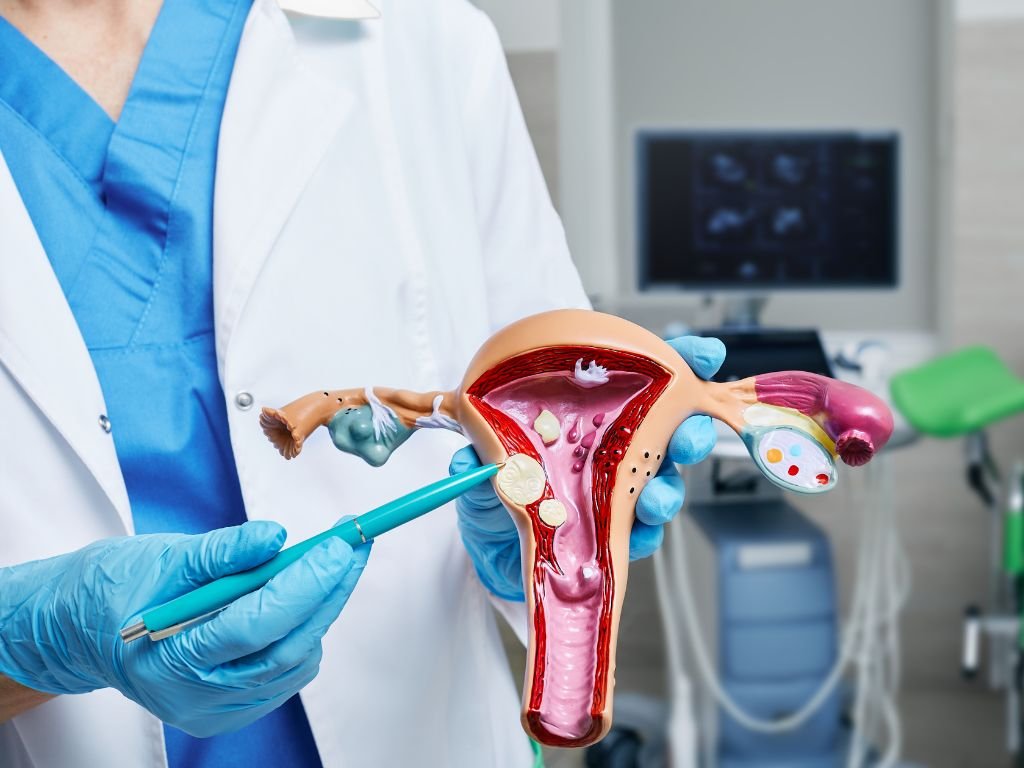 Gynecologist pointing uterine leiomyomas on anatomical model of uterus while female patient's gynecological consultation